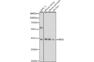 Western blot analysis of extracts of various cell lines, using NEU1 antibody (ABIN6129462, ABIN6144538, ABIN6144539 and ABIN6221903) at 1:1000 dilution.