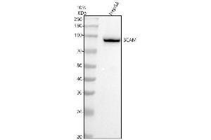 Western blot analysis of BCAM using anti-BCAM antibody (ABIN7604312).