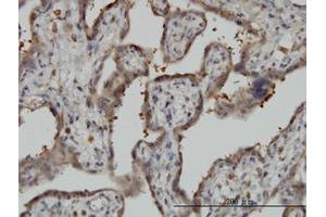 Image no. 2 for anti-5'-Nucleotidase, Cytosolic II (NT5C2) (AA 1-562) antibody (ABIN599188) (NT5C2 anticorps  (AA 1-562))