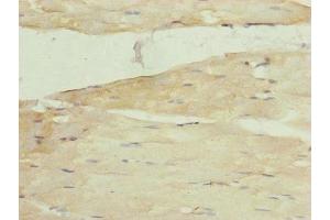 Immunohistochemistry of paraffin-embedded human skeletal muscle tissue using ABIN7142260 at dilution of 1:100 (MRPS22 anticorps  (AA 1-360))