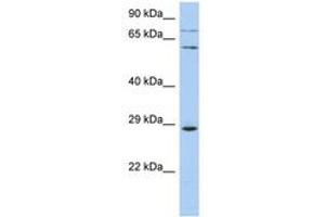 Image no. 1 for anti-Zinc Finger Protein 490 (ZNF490) (AA 107-156) antibody (ABIN6742632) (ZNF490 anticorps  (AA 107-156))