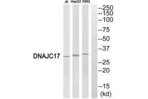 Western blot analysis of extracts from Jurkat cells, HepG2 cells and K562 cells, using DNAJC17 antibody. (DNAJC17 anticorps  (N-Term))