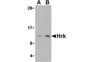 Image no. 1 for anti-Harakiri, BCL2 Interacting Protein (Contains Only BH3 Domain) (HRK) (Middle Region) antibody (ABIN318751)