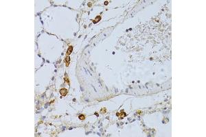 Immunohistochemistry of paraffin-embedded rat lung using PHGDH antibody (ABIN4904748) at dilution of 1:100 (40x lens). (PHGDH anticorps)