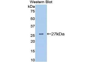 Western Blotting (WB) image for anti-Clusterin (CLU) (AA 227-448) antibody (ABIN3207143) (Clusterin anticorps  (AA 227-448))