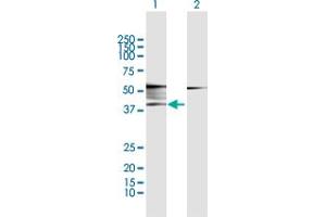 Western Blot analysis of ADRB2 expression in transfected 293T cell line by ADRB2 MaxPab polyclonal antibody. (beta 2 Adrenergic Receptor anticorps  (AA 1-413))