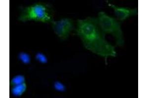 Image no. 9 for anti-Mitogen-Activated Protein Kinase Kinase 1 (MAP2K1) antibody (ABIN1499381)