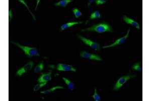 Immunofluorescence staining of Hela cells with ABIN7169960 at 1:100, counter-stained with DAPI. (SLC5A8 anticorps  (AA 540-610))