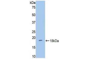 Western blot analysis of recombinant Mouse DPP4. (DPP4 anticorps  (AA 631-760))