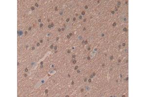 Used in DAB staining on fromalin fixed paraffin- embedded Kidney tissue (LDOC1 anticorps  (AA 1-146))