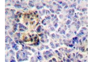Immunohistochemistry analyzes of Moesin antibody in paraffin-embedded human pancreas tissue. (Moesin anticorps)