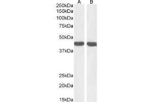 (ABIN185271) (1 μg/mL) staining of HeLa (A) and NIH3T3 (B) cell lysate (35 μg protein in RIPA buffer).