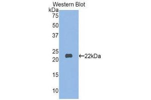Western Blotting (WB) image for anti-Myosin, Light Chain 3 (MYL3) (AA 5-181) antibody (ABIN1859940) (MYL3/CMLC1 anticorps  (AA 5-181))