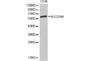 Western blot analysis of extracts of CEM cell lines, using SLC22A6 antibody. (SLC22A6 anticorps)