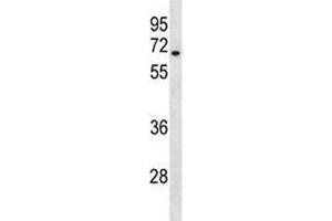 HAS3 antibody western blot analysis in A549 lysate. (HAS3 anticorps  (AA 137-164))