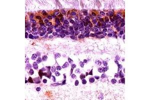 Immunohistochemical analysis of Cone Arrestin staining in human retina formalin fixed paraffin embedded tissue section. (ARR3 anticorps  (C-Term))
