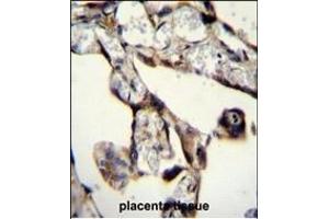 SASH1 Antibody (Center) (ABIN655510 and ABIN2845026) immunohistochemistry analysis in formalin fixed and paraffin embedded human placenta tissue followed by peroxidase conjugation of the secondary antibody and DAB staining.