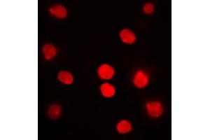 Immunofluorescent analysis of DBF4 staining in HepG2 cells. (DBF4 anticorps  (N-Term))