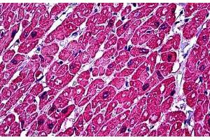 Human Heart: Formalin-Fixed, Paraffin-Embedded (FFPE)