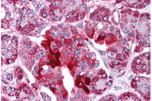 Human Pancreas: Formalin-Fixed, Paraffin-Embedded (FFPE)