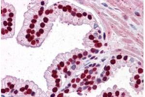 Human Prostate: Formalin-Fixed, Paraffin-Embedded (FFPE)