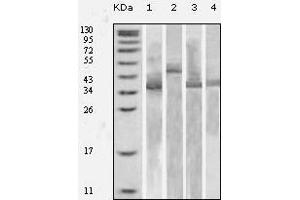 Western blot analysis using Trx mouse mAb against various fusion protein with Trx tag. (TXN anticorps)