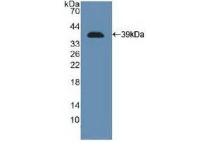 Detection of Recombinant NCAM, Human using Polyclonal Antibody to Cluster Of Differentiation 56 (CD56) (CD56 anticorps  (AA 340-608))