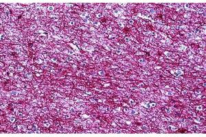 Human Brain, Cortex: Formalin-Fixed, Paraffin-Embedded (FFPE) (GFAP anticorps)