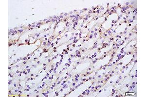 anti-Transforming Growth Factor beta Regulator 1 (TBRG1) (AA 28-130) antibody