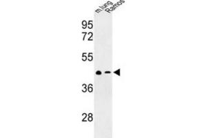 Western Blotting (WB) image for anti-Chemokine (C-X-C Motif) Receptor 7 (CXCR7) antibody (ABIN3003904) (CXCR7 anticorps)