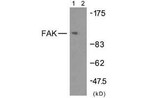 Western blot analysis of extracts from HeLa cells using FAK (Ab-925) antibody (E021148). (FAK anticorps)