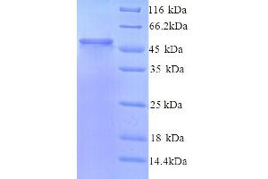 SDS-PAGE (SDS) image for Lectin, Mannose-Binding 1 Like (LMAN1L) (AA 26-462) protein (His tag) (ABIN5714464)