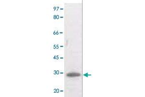 The whole cell lysate derived from UV treated Raji cell was separated in 10% SDS-PAGE, transferred onto NC membrane, and immunoblotted by BCL2 (phospho T129) polyclonal antibody  at 1 : 500. (Bcl-2 anticorps  (pThr129))