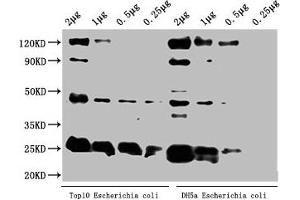 Western Blot Positive WB detected in: Top10 Escherichia coli lysate, DH5α Escherichia coli lysate All lanes: alaA antibody at 1:2000 Secondary Goat polyclonal to rabbit IgG at 1/50000 dilution Predicted band size: 46 kDa Observed band size: 46 kDa (ALAA (AA 1-405) anticorps)
