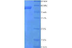 serpin Peptidase Inhibitor, Clade B (Ovalbumin), Member 2 (SERPINB2) (AA 1-416), (full length) protein (His tag)