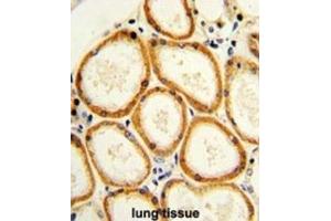 Immunohistochemistry (IHC) image for anti-Caspase 2, Apoptosis-Related Cysteine Peptidase (CASP2) antibody (ABIN2997249)