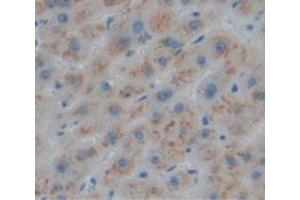 IHC-P analysis of Human Tissue, with DAB staining. (LACTB anticorps  (AA 313-547))