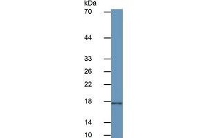 Mouse Capture antibody from the kit in WB with Positive Control: Human Stomach lysate.