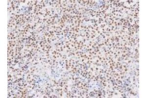 Immunohistochemistry (IHC) image for anti-TAR DNA Binding Protein (TARDBP) (AA 1-260), (N-Term) antibody (ABIN317572)
