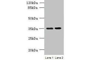 Western blot All lanes: CFAP65 antibody at 8 μg/mL Lane 1: U251 whole cell lysate Lane 2: U87 whole cell lysate Secondary Goat polyclonal to rabbit IgG at 1/10000 dilution Predicted band size: 218, 19, 82, 88 kDa Observed band size: 35 kDa