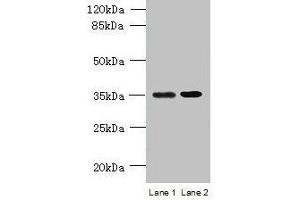 Western blot All lanes: CFAP65 antibody at 8 μg/mL Lane 1: U251 whole cell lysate Lane 2: U87 whole cell lysate Secondary Goat polyclonal to rabbit IgG at 1/10000 dilution Predicted band size: 218, 19, 82, 88 kDa Observed band size: 35 kDa (CCDC108 anticorps  (AA 2-164))