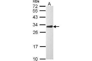 WB Image Sample (30 ug of whole cell lysate) A: Raji 12% SDS PAGE antibody diluted at 1:1000 (CLIC4 anticorps)