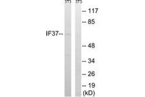 Western blot analysis of extracts from NIH-3T3 cells, using EIF3D Antibody. (EIF3D anticorps  (AA 101-150))