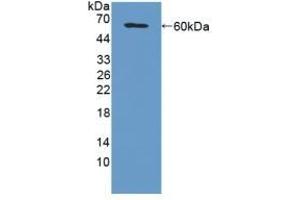 Detection of Recombinant MFAP2, Mouse using Polyclonal Antibody to Microfibrillar Associated Protein 2 (MFAP2)