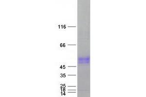 Validation with Western Blot
