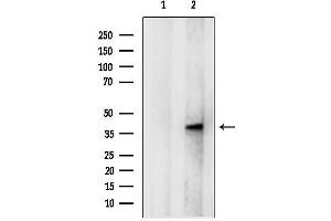 anti-UDP-GlcNAc:betaGal beta-1,3-N-Acetylglucosaminyltransferase 3 (B3GNT3) (C-Term) antibody