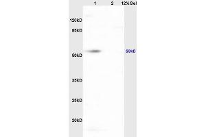 Lane 1: mouse heart lysates Lane 2: mouse brain lysates probed with Anti HCLS1/LckBP1 Polyclonal Antibody, Unconjugated (ABIN709811) at 1:200 in 4 °C. (HCLS1 anticorps  (AA 161-260))