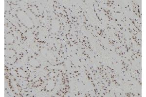ABIN6273566 at 1/100 staining Human kidney tissue by IHC-P. (ZNF713 anticorps)