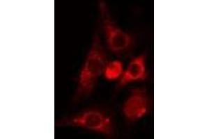 ABIN6275051 staining Hela cells by IF/ICC.