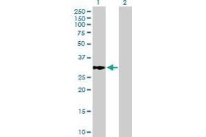 Western Blot analysis of ECHDC1 expression in transfected 293T cell line by ECHDC1 MaxPab polyclonal antibody. (ECHDC1 anticorps  (AA 1-301))